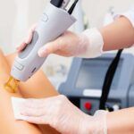 Dolor depilación IPL
