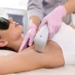 Preparación IPL